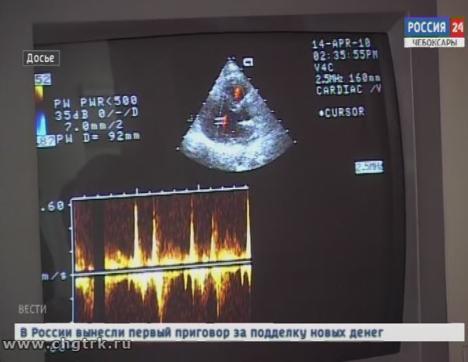 В нескольких поликлиниках Чувашии пройдет день открытых дверей