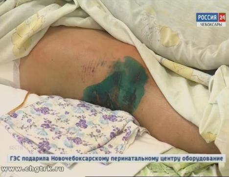 Уличный, школьный и бытовой травматизм: как не оказаться на больничной койке в новогодние каникулы? 