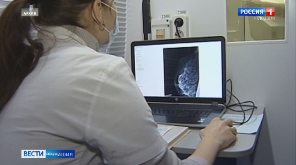  861 женщина в Чувашии обследовалась в передвижных маммографах в течение января 