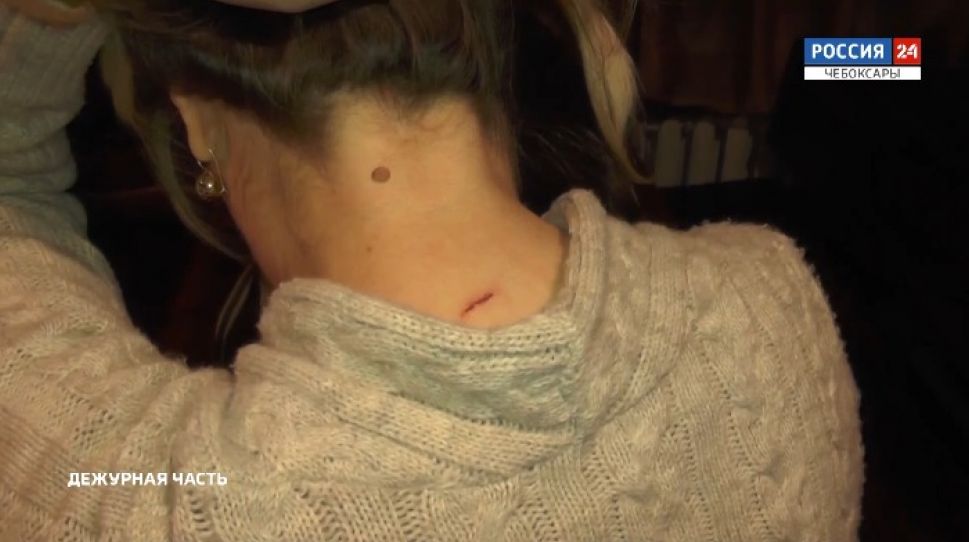 В чебоксарском кафе посетитель напал на бармена с ножом