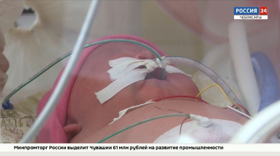 В Минздраве Чувашии рассказали о самом действенном методе профилактики младенческой смертности