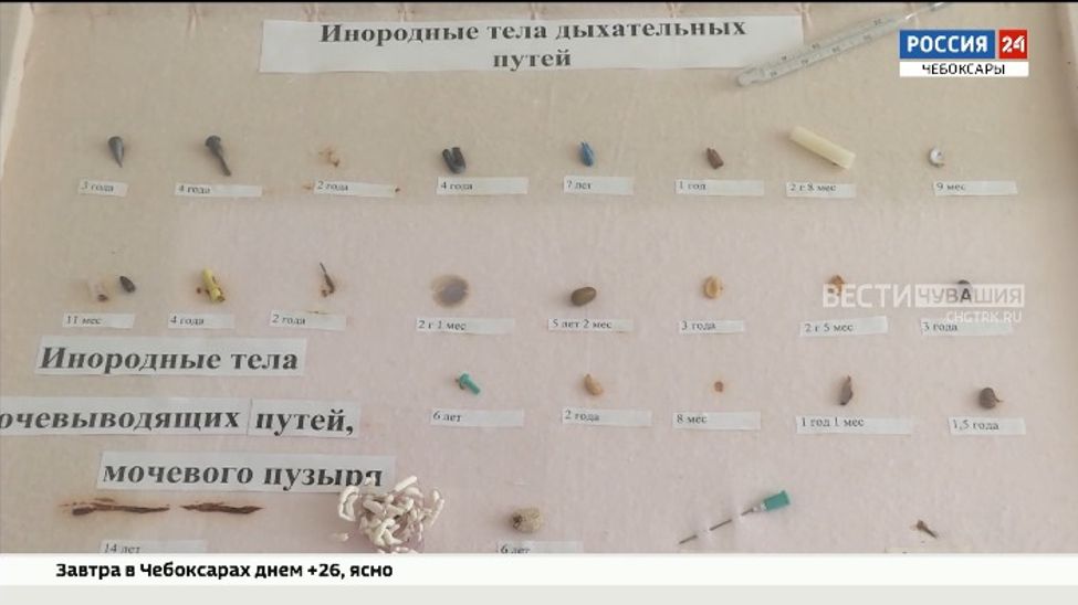 Хирурги Чувашии всё чаще сталкиваются со случаями, когда дети проглатывают мелкие предметы