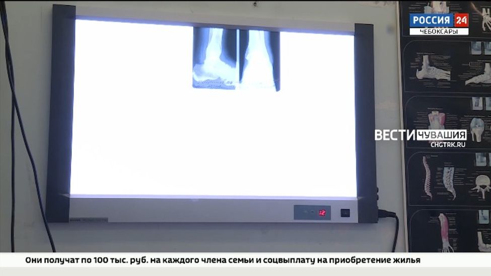 Врачи Чувашии рассказали, как избежать травм зимой