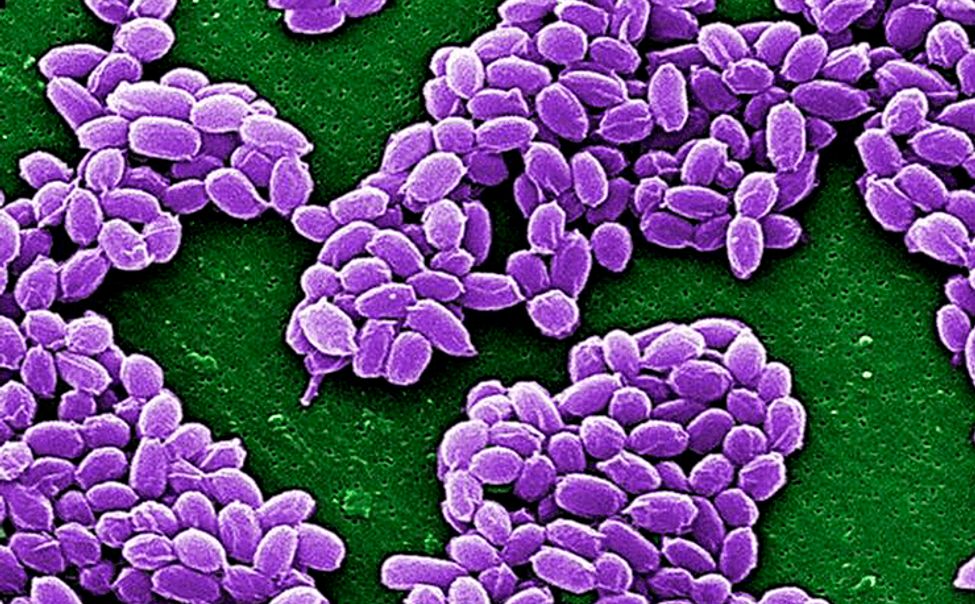 В Чувашию поступило 750 доз сибироязвенной вакцины