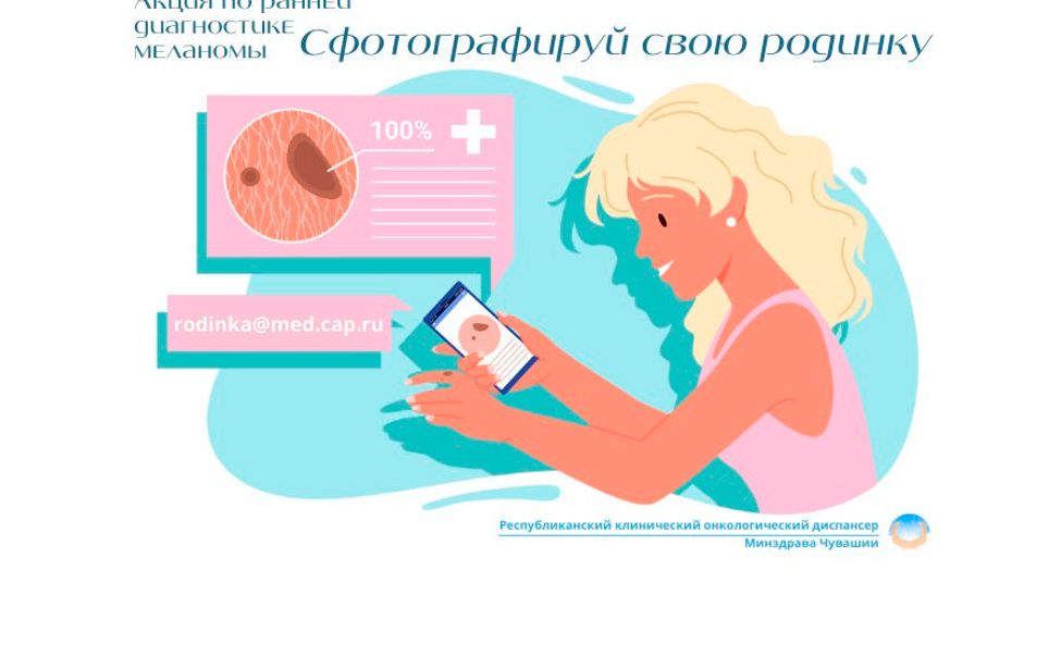 В Чувашии возобновляют акцию "Сфотографируй свою родинку"