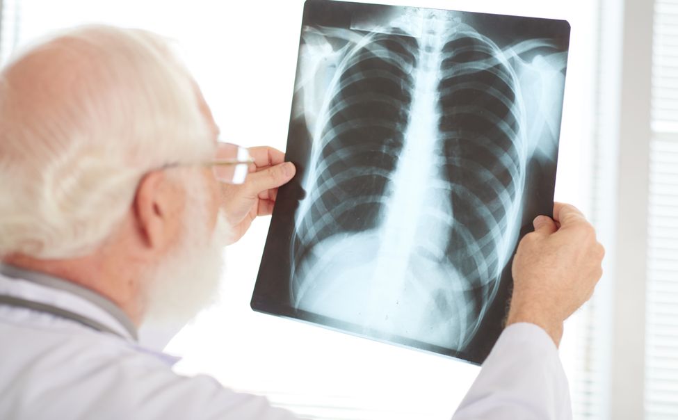 Больных туберкулезом жителей Шумерли отправили на принудительное лечение