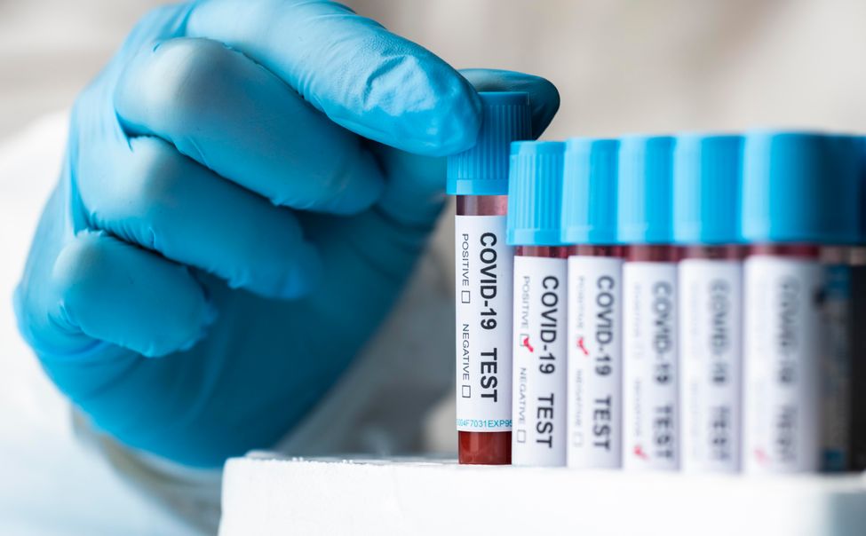 В Чувашии за неделю выявлено почти 300 случаев ковида 