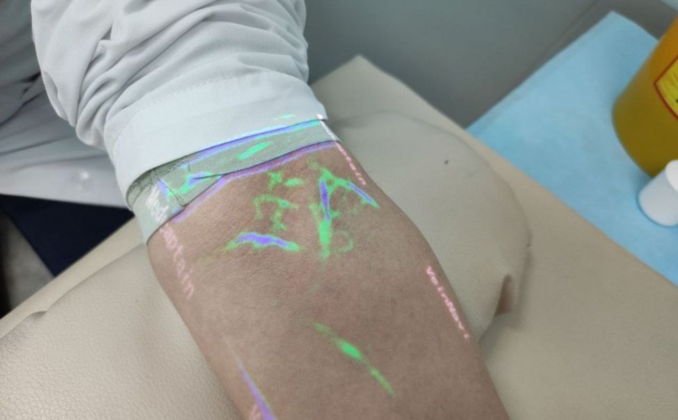 В Центральной городской больнице появился венолокатор