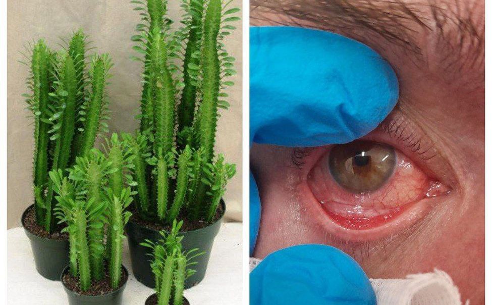 Житель Чувашии чуть не ослеп, пересаживая цветы