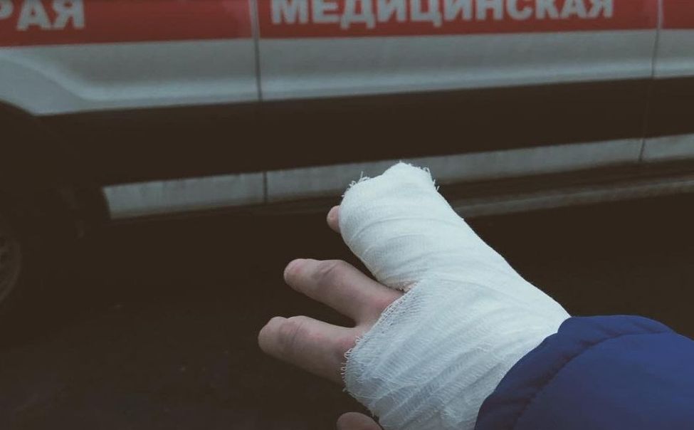 В новогодние праздники в Чувашии от петард пострадали 2 человека