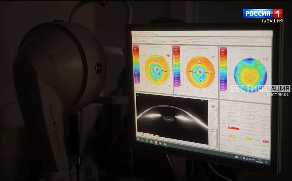 В Чебоксарах врачи сохранили зрение гражданину Греции с глаукомой
