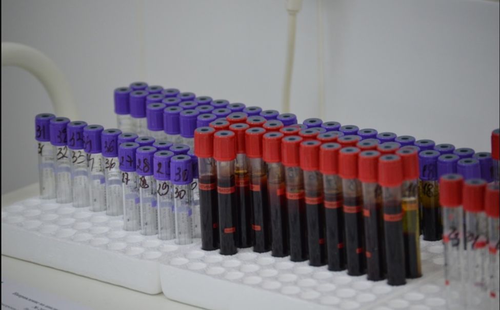 В Новочебоксарской горбольнице за год вылечили более 90 пациентов с гепатитом C